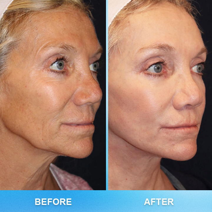 Made and Shipped from USA✨LIMETOW™ Anti-Wrinkle Firming Multi-Purpose Cream(🔥LAST DAY 50% OFF)💄
