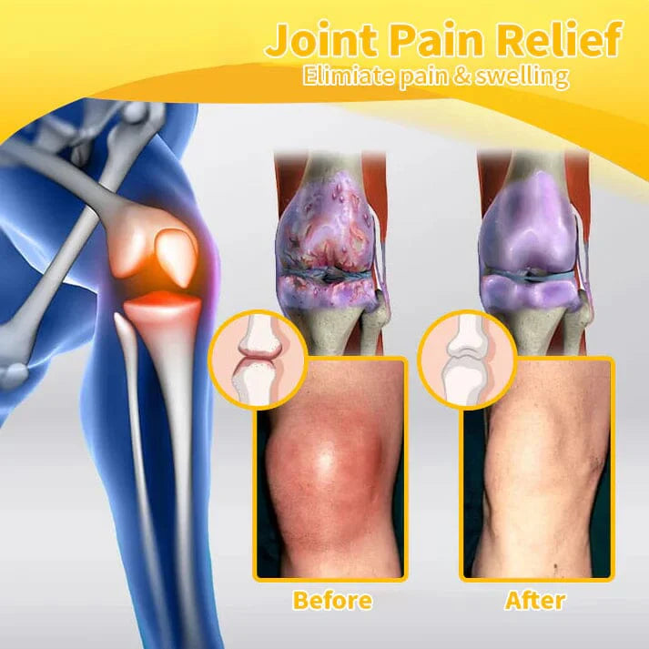 BeeRx BeeThera | Bee Venom-Infused Relief for Bones & Joints