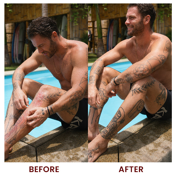 LIMETOW® Natural Tattoo Balm