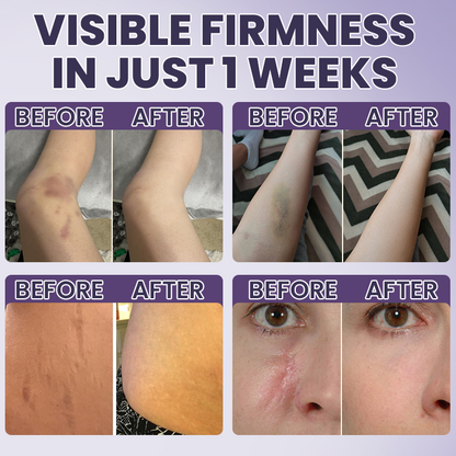LIMETOW® Bruise Repair & Skin-Strengthening Cream