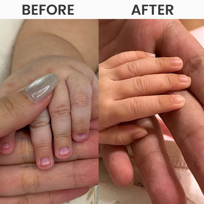 LIMETOW® Electric Nail Clipper