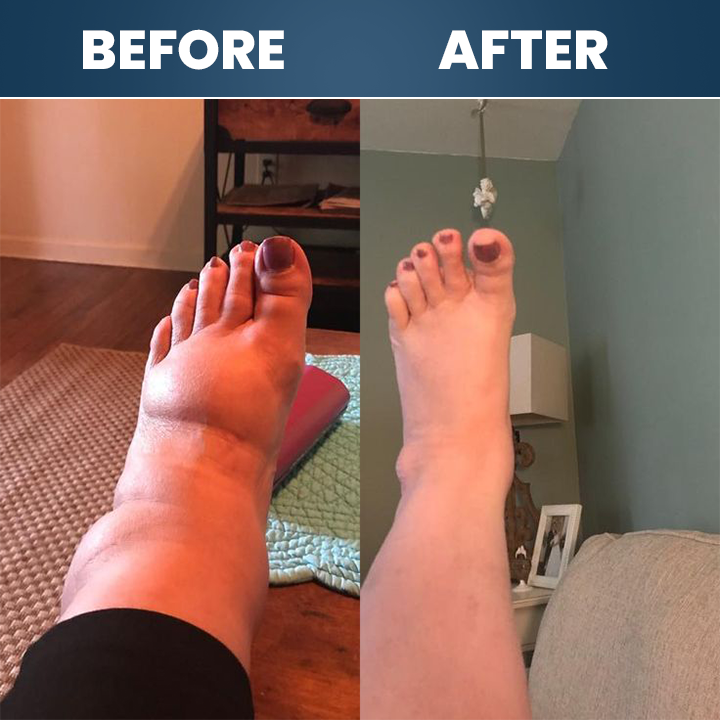 LIMETOW® Neuropathy Relief Cream