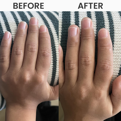 LIMETOW® Electric Nail Clipper