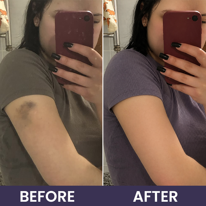 LIMETOW® Bruise Repair & Skin-Strengthening Cream
