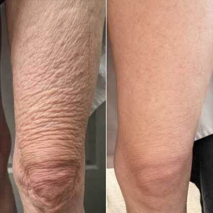 LIMETOW® Collagen Firming Cream💖LAST DAY SALE - 70% OFF