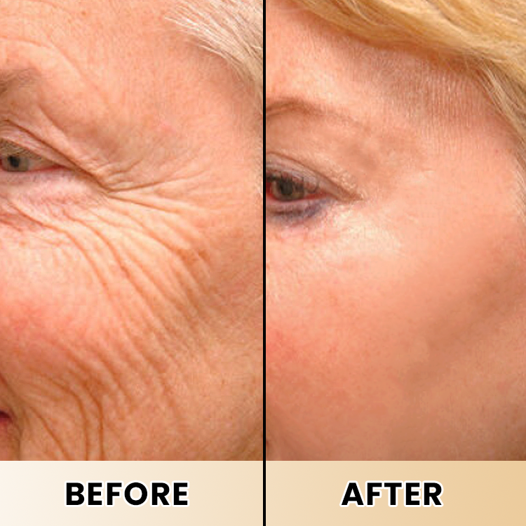 LIMETOW® Collagen Lifting Body Oil