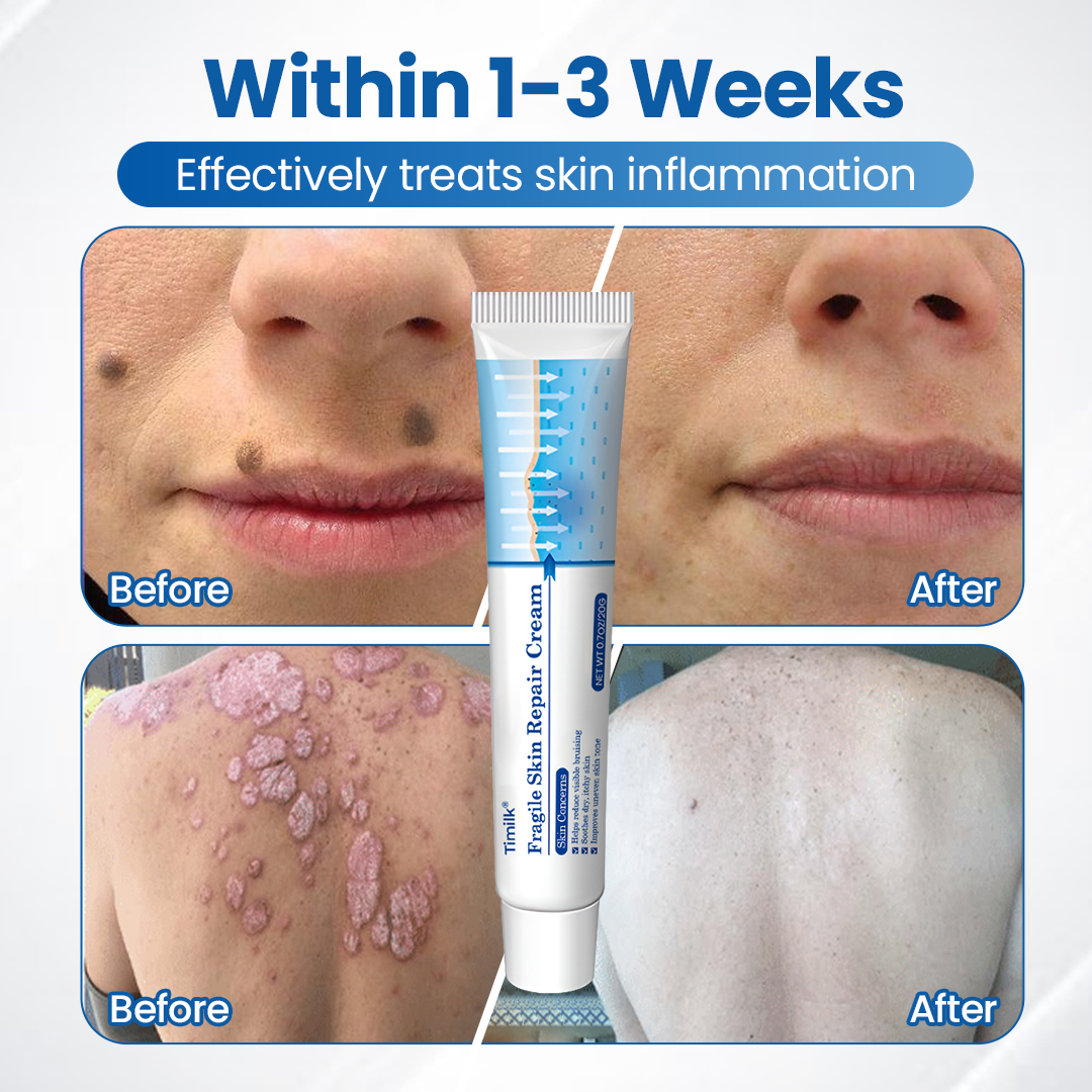 LIMETOW® Fragile Skin Repair Cream🛡️🌿 Multi-Repair for Bruises, Dryness & Spots
