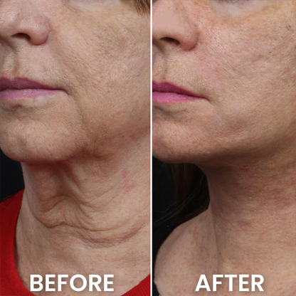 LIMETOW® Deep Collagen Silk Peptide Intensive Ampoule