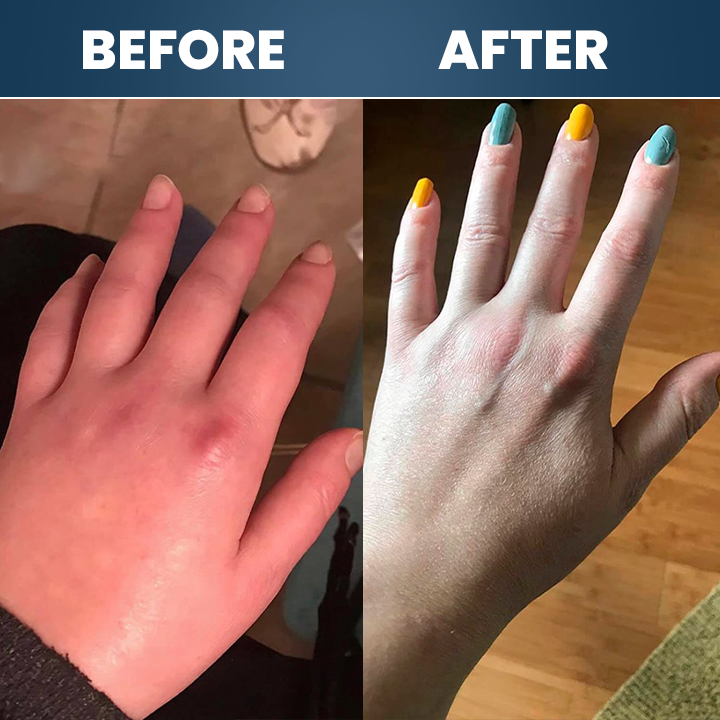 LIMETOW® Neuropathy Relief Cream