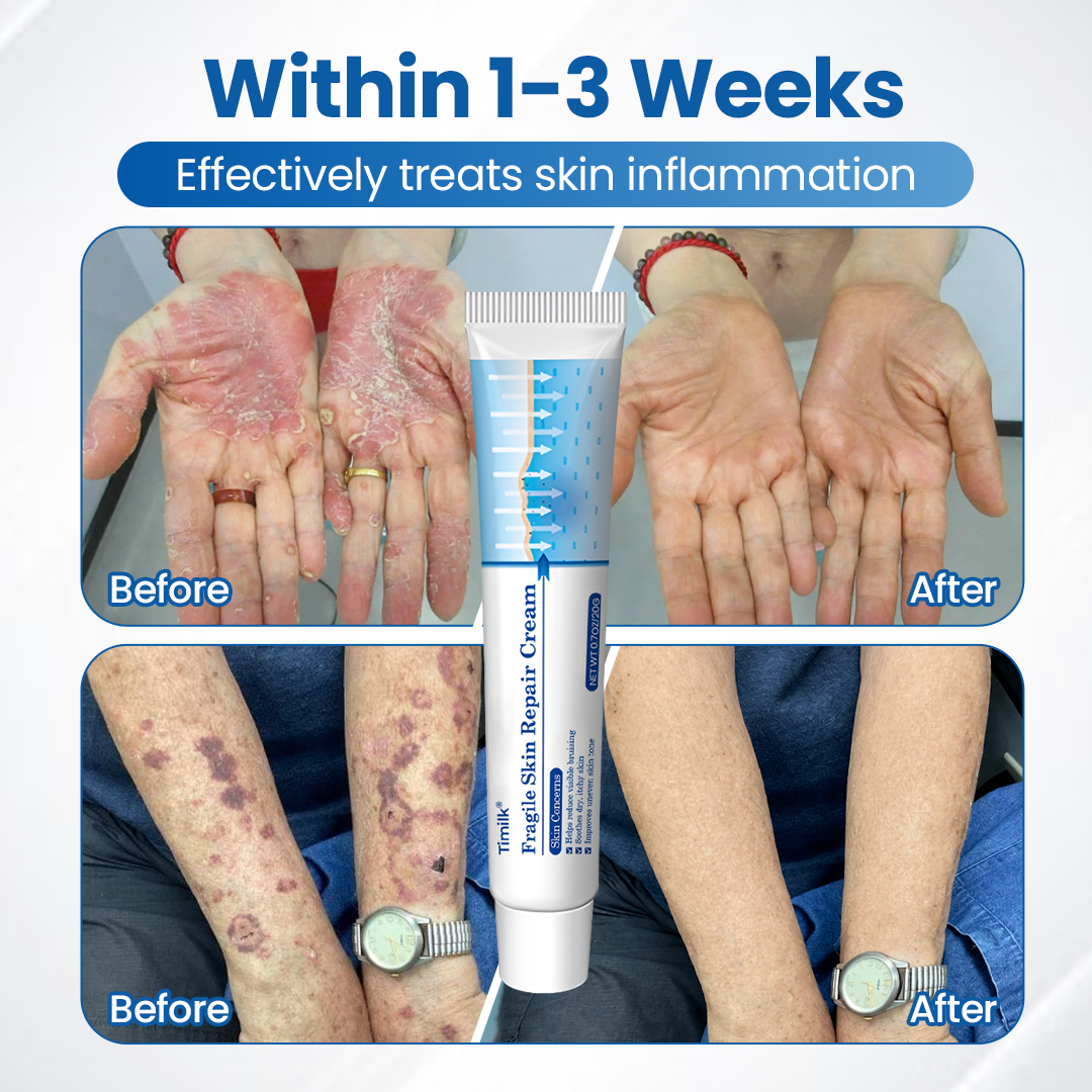 LIMETOW® Fragile Skin Repair Cream🛡️🌿 Multi-Repair for Bruises, Dryness & Spots