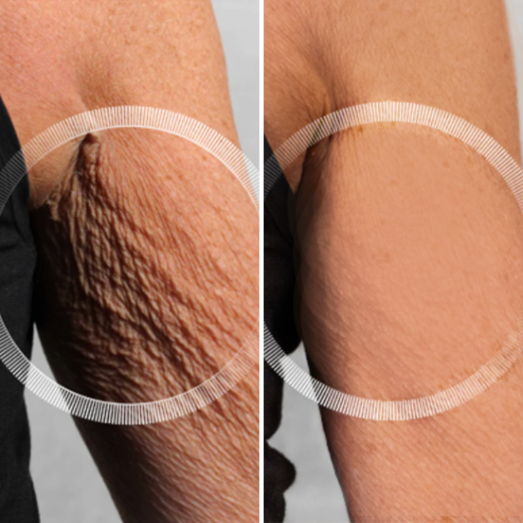 LIMETOW® Bee Venom Firming & Anti-Wrinkle Cream