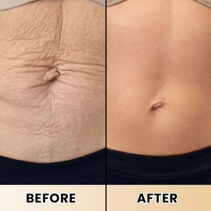 LIMETOW® Collagen Lifting Body Oil