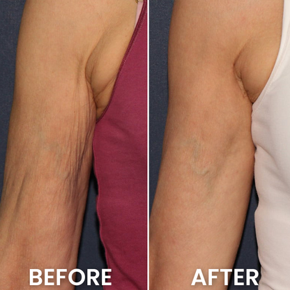 LIMETOW® Deep Collagen Silk Peptide Intensive Ampoule