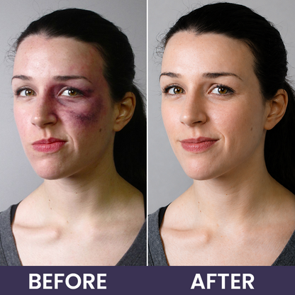LIMETOW® Bruise Repair & Skin-Strengthening Cream