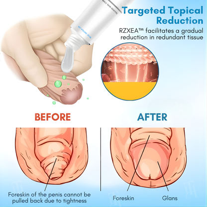 Foreskin Elasticity Gel：Restore Foreskin Elasticity — Pain-Free Tightness Relief! ⚡