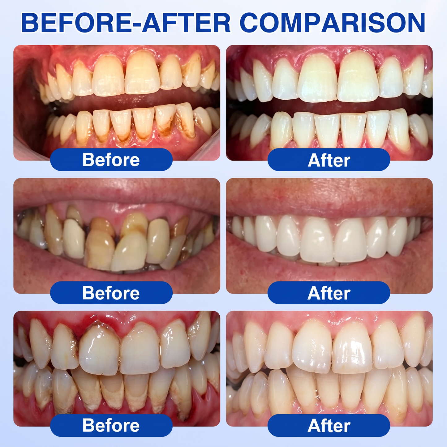 🇬🇧Glimmerly® 🦷GumRevive periodontal repair gel🍀