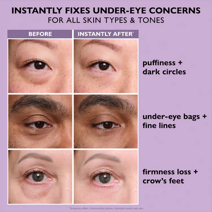 LIMETOW™ Instant Eye Tightener - Tightens, Firms, & Blurs Wrinkles
