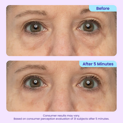 LIMETOW™ Instant Eye Tightener - Tightens, Firms, & Blurs Wrinkles