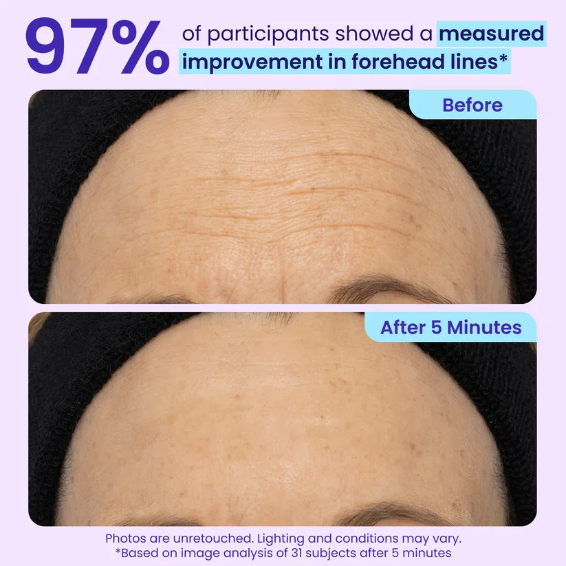 LIMETOW™ Instant Eye Tightener - Tightens, Firms, & Blurs Wrinkles