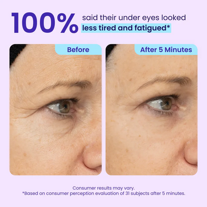 LIMETOW™ Instant Eye Tightener - Tightens, Firms, & Blurs Wrinkles