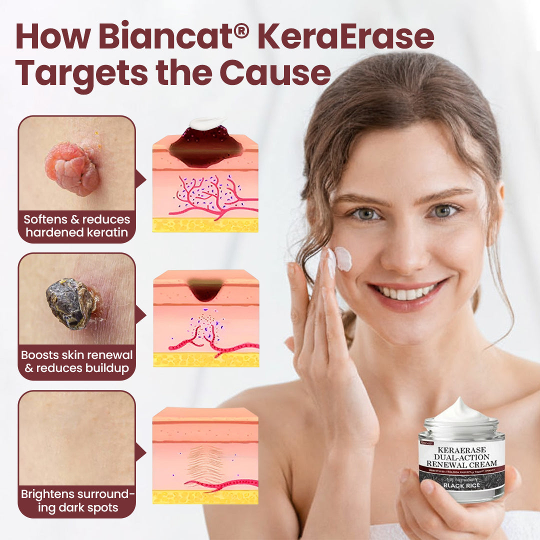 LIMETOW® KeraErase Dual-Action Renewal Cream🔥🔥
