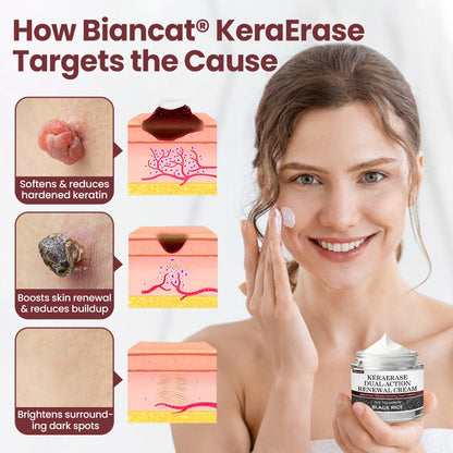 LIMETOW® KeraErase Dual-Action Renewal Cream🔥🔥