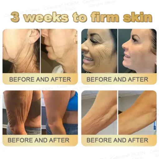LIMETOW® PDRN Multi-Peptide Firming Serum Stick