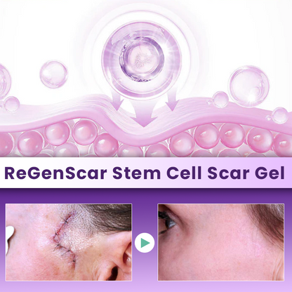 LIMETOW® ReGenScar Stem Cell Scar Gel