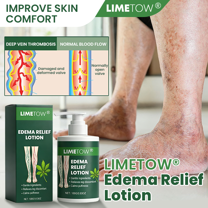 LIMETOW® Edema Relief Lotion