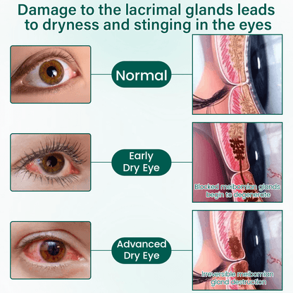 BalanceVie OptiClear Nano Eye Roller Serum