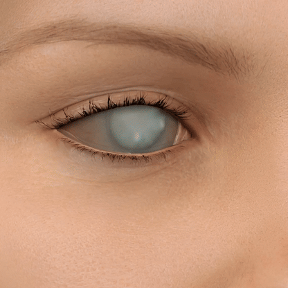 BalanceVie OptiClear Nano Eye Roller Serum
