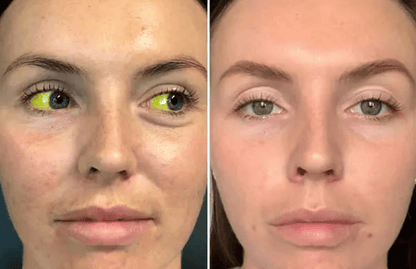 BalanceVie OptiClear Nano Eye Roller Serum