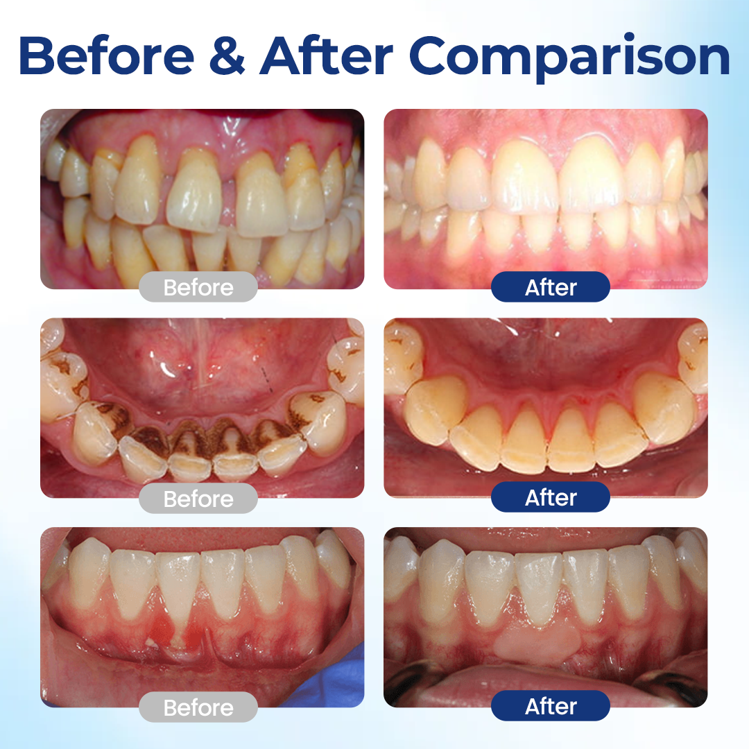 LIMETOW® BeeTakt Oral Repair Solution🔥🔥