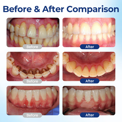 LIMETOW® BeeTakt Oral Repair Solution🔥🔥