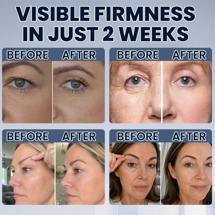 LIMETOW® Lid Lifting Treatment