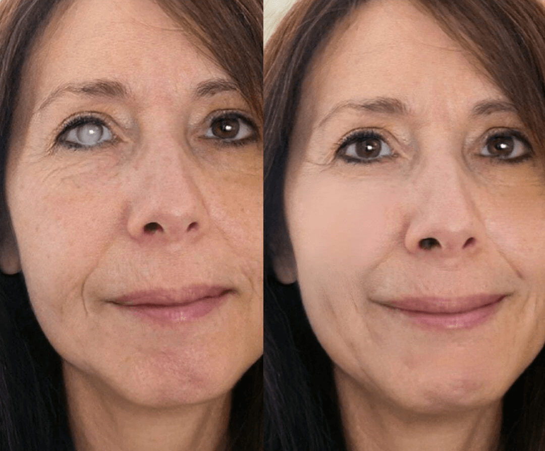 BalanceVie OptiClear Nano Eye Roller Serum