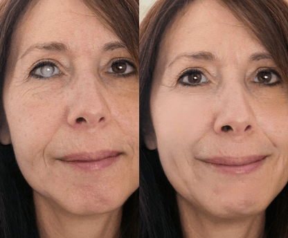 BalanceVie OptiClear Nano Eye Roller Serum