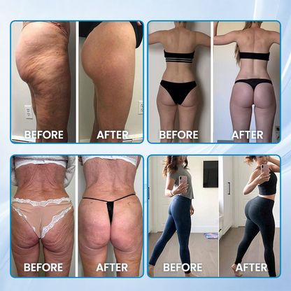 LIMETOW® Buttocks Up Lipo Patch