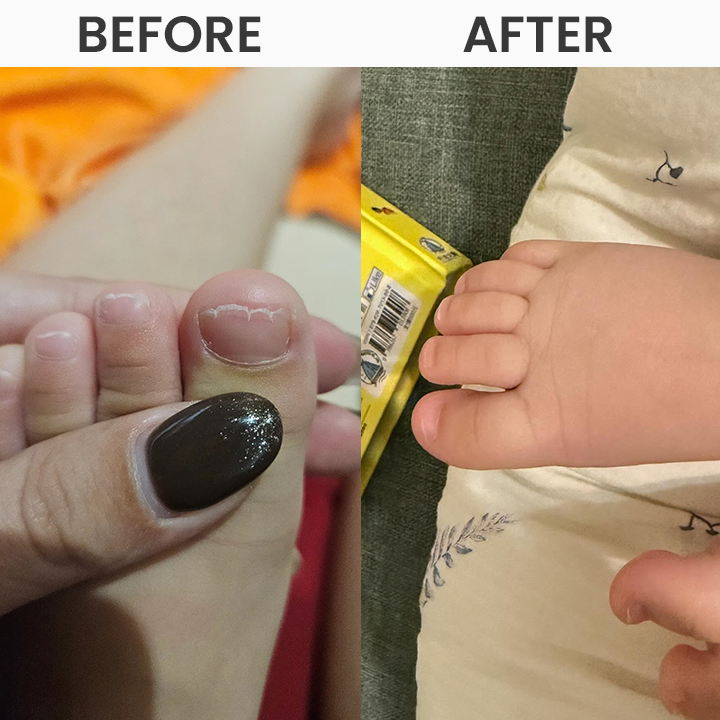 LIMETOW® Electric Nail Clipper