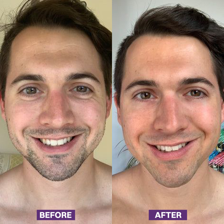 LIMETOW® Eye Bag Firming Cream