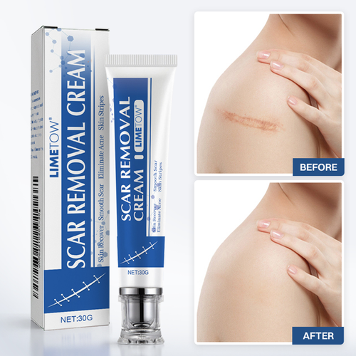 LIMETOW® Scar Removal Cream