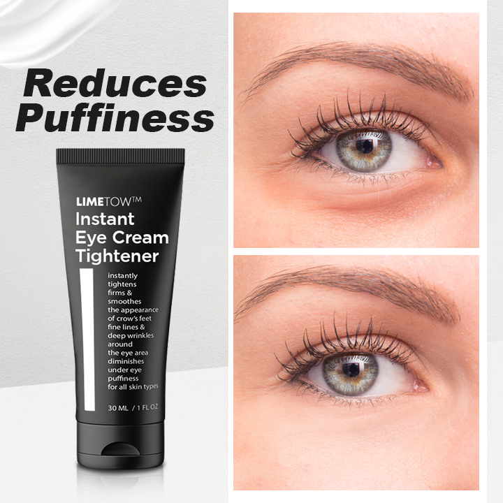 LIMETOW™🔥 Instant Eye Cream Tightener 🔥