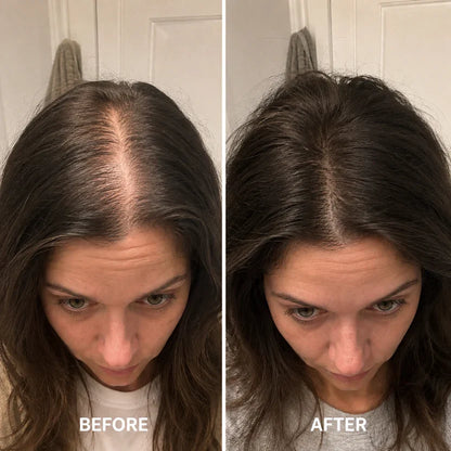LIMETOW® Deoxyribose Scalp Serum