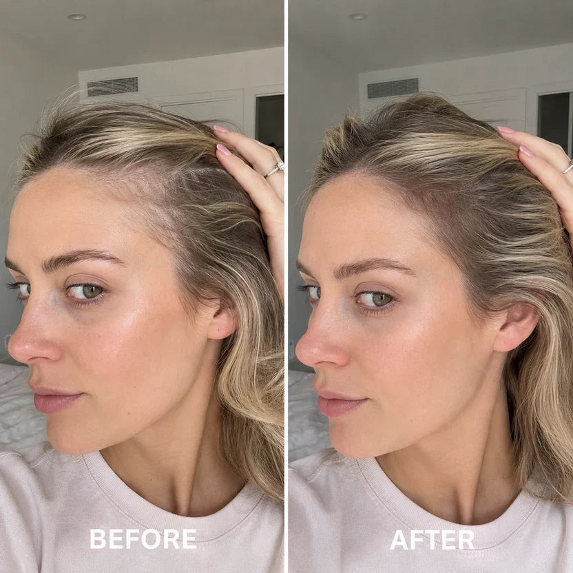 LIMETOW® Deoxyribose Scalp Serum