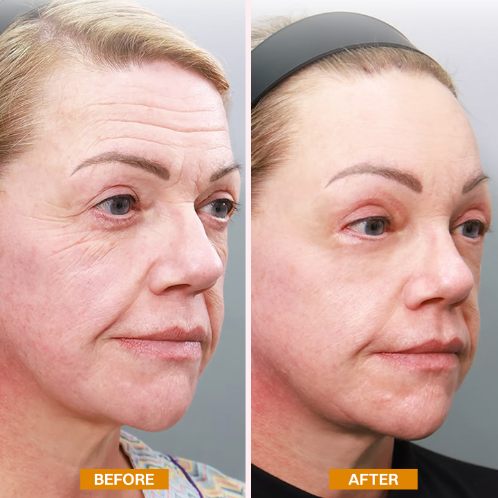LIMETOW® Retinol Eyebag Cream