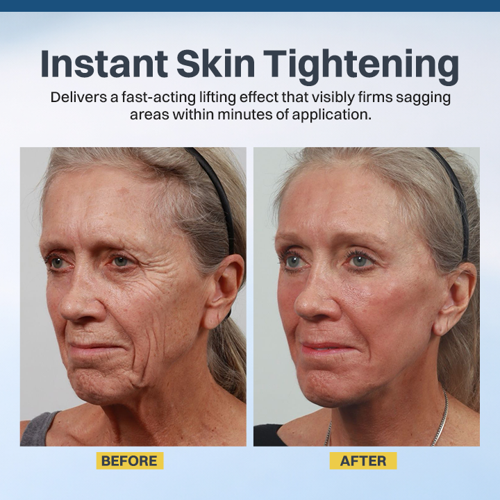 LIMETOW® Facelift Serum