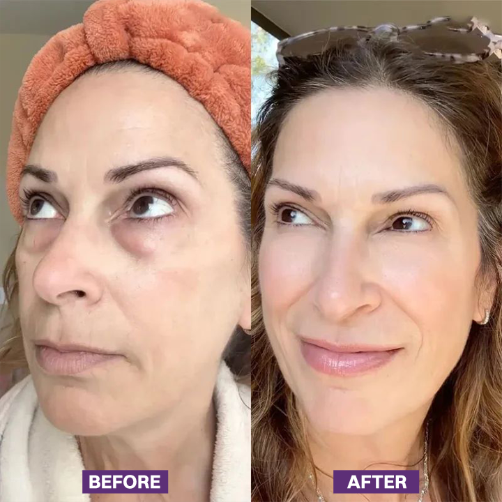 LIMETOW® Eye Bag Firming Cream