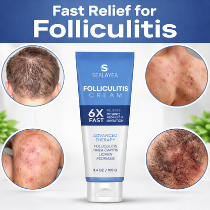 LIMETOW®Tired of Painful Bumps? This Cream Calms Folliculitis Fast