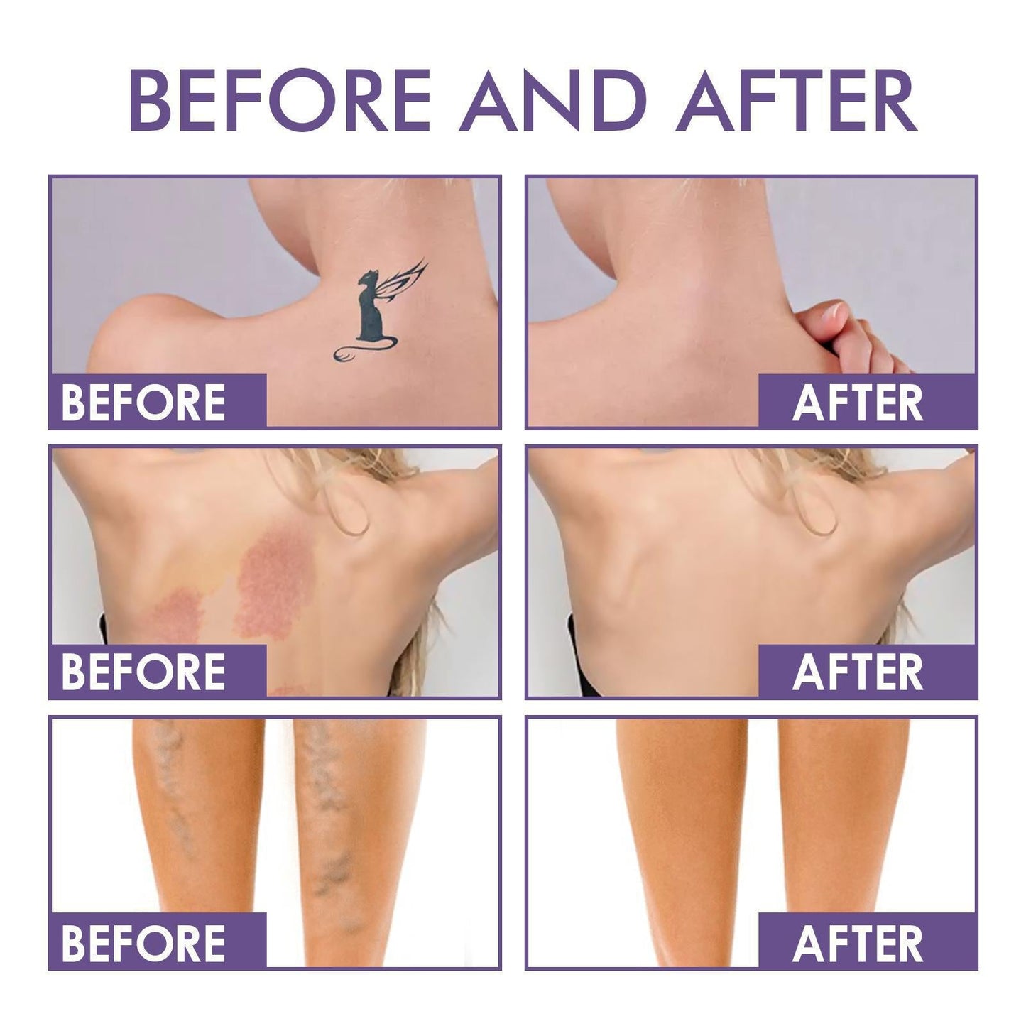 LIMETOW® Instant Face Tightener – Visible Smoothing in 60 Seconds, Progressive Results in 18 Days