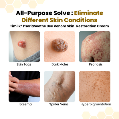 LIMETOW® PsoriaSoothe Skin Care Cream